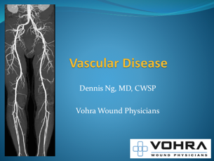 Vascular Disease - Presentation